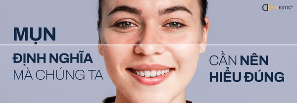 MỤN - ĐỊNH NGHĨA MÀ CHÚNG TA CẦN NÊN HIỂU ĐÚNG
