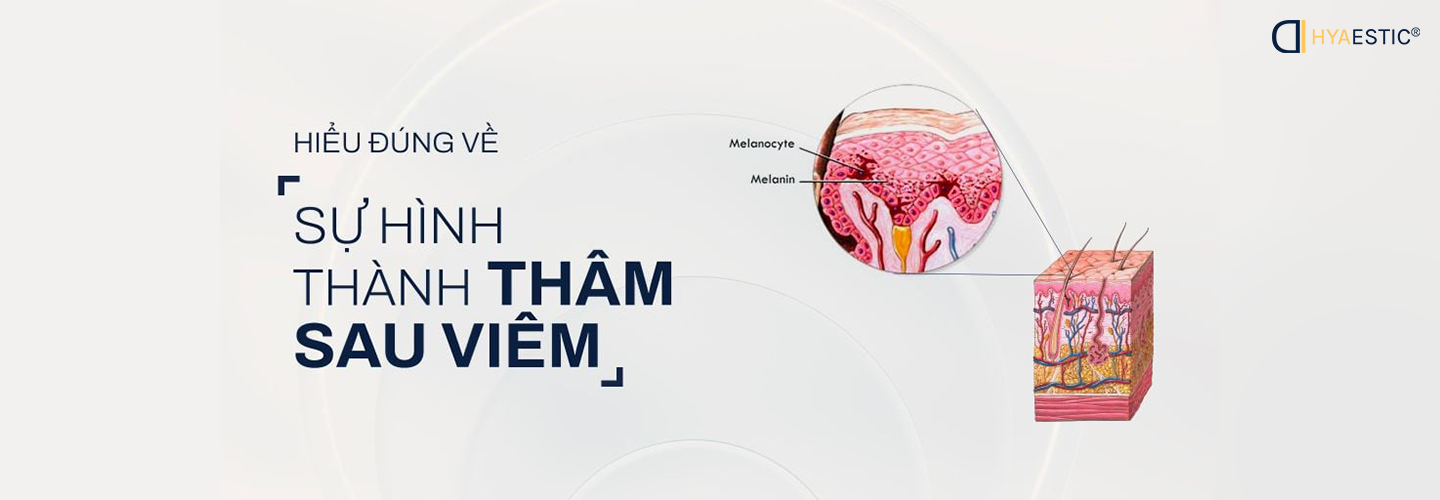 HIỂU ĐÚNG VỀ SỰ HÌNH THÀNH THÂM SAU VIÊM