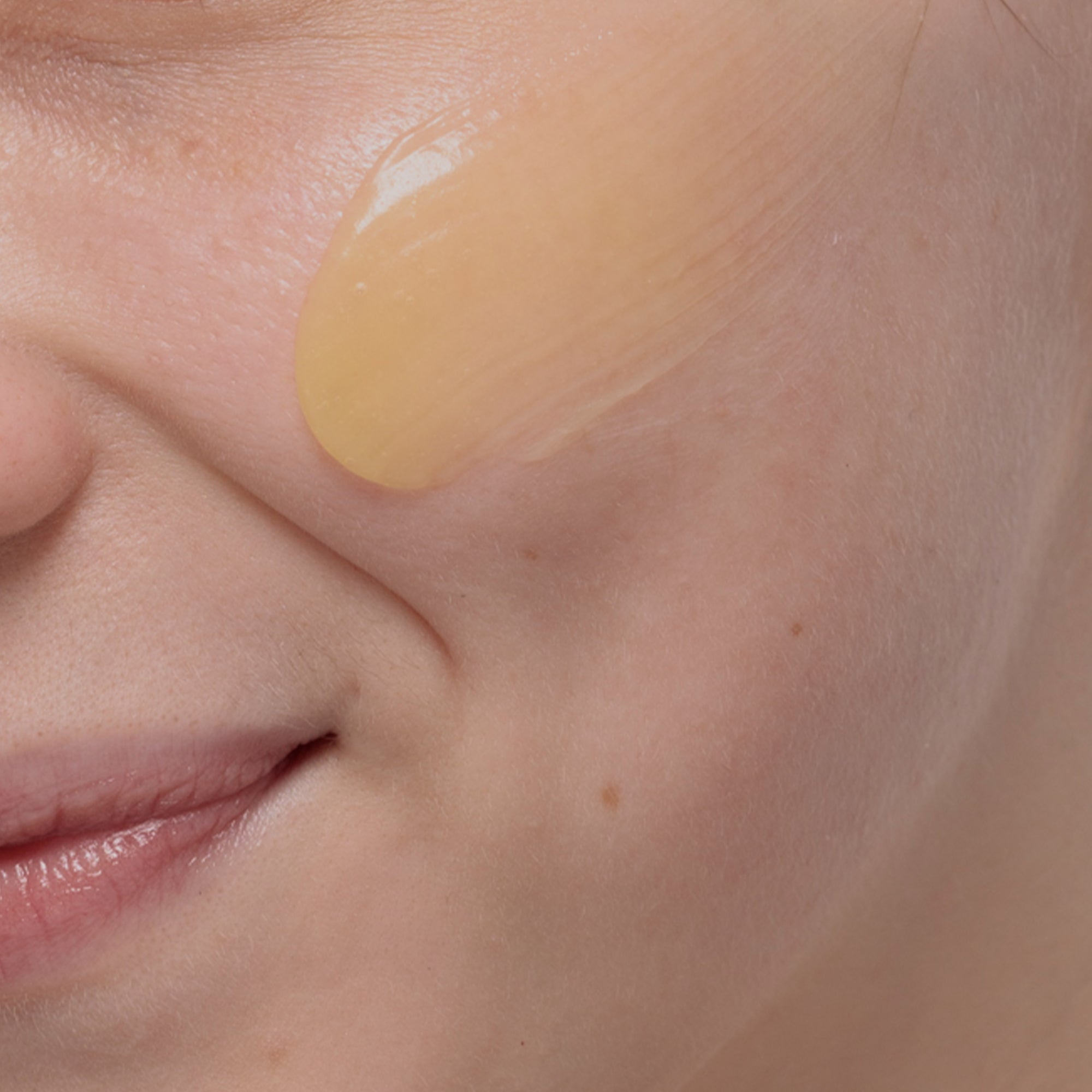 Tế bào gốc trẻ hoá và hỗ trợ phục hồi làn da sẹo Hyaestic Scar Recovery & Barrier Strengthen Cream